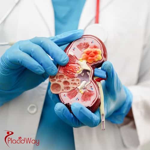 Mini Gastric Bypass in Turkey: A Quick and Effective Weight Loss Procedure for German Patients
